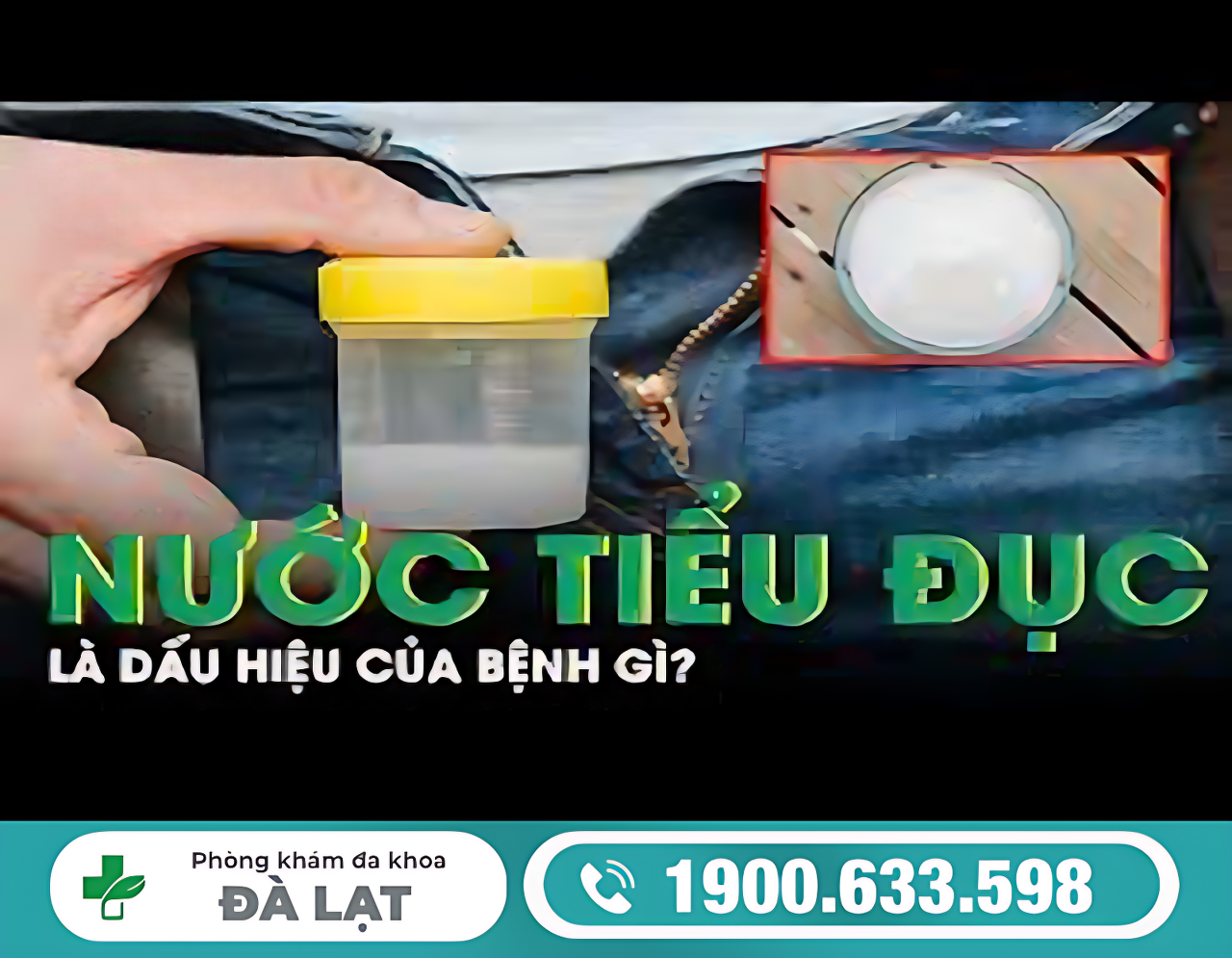 Hình ảnh minh họa